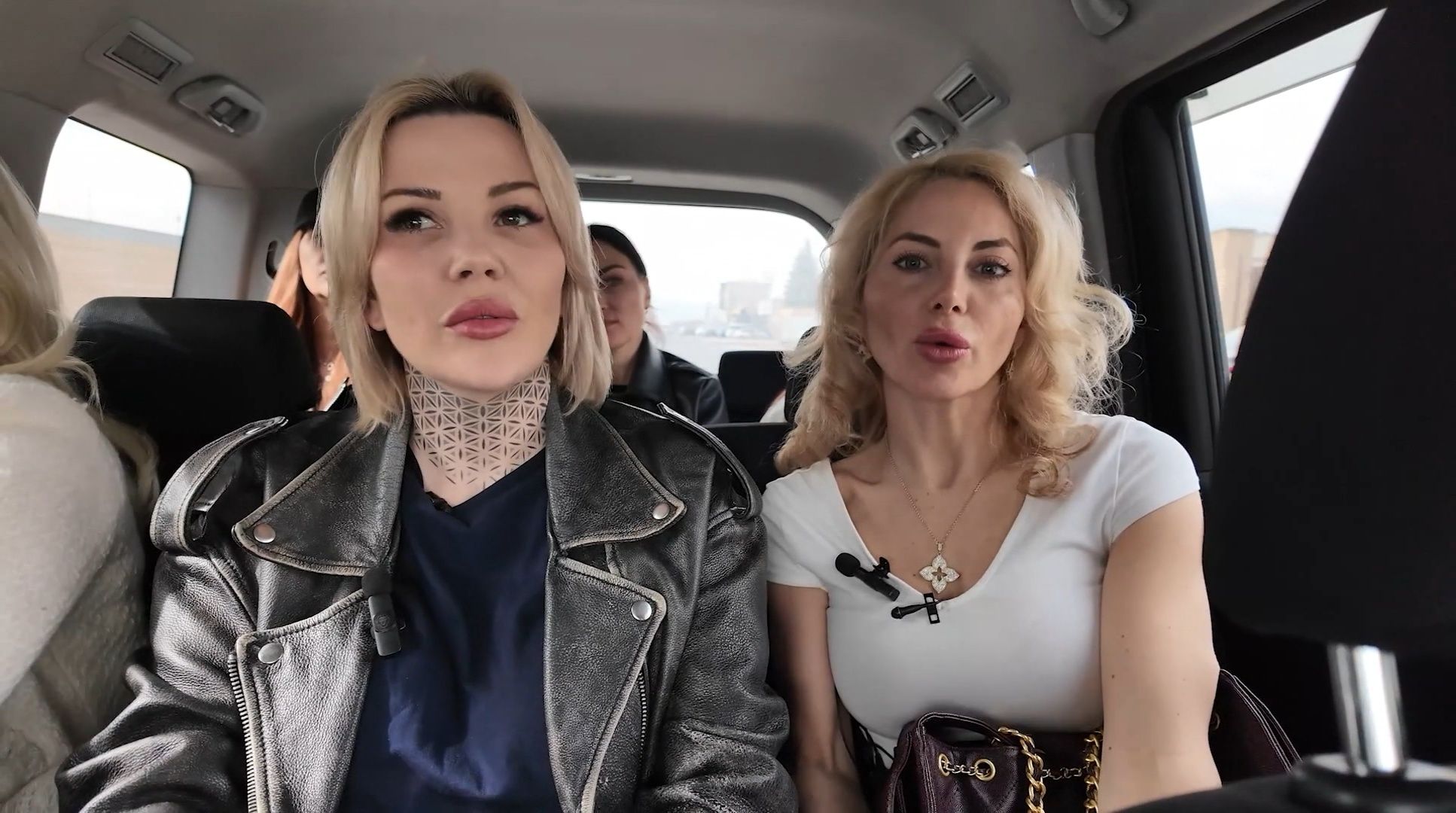 Jesica Zundovska parāda, kādu rezultātu sagaida pēc plastiskās operācijas